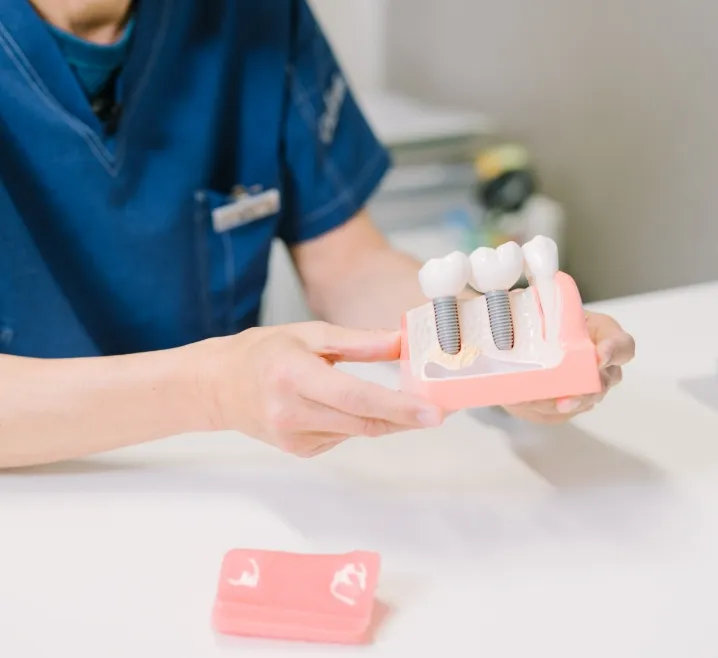 インプラントイマジネーション インプラント | 横浜市緑区