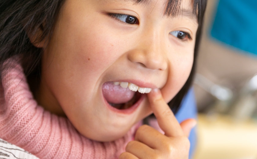 歯並びが悪くなる原因を改善 口腔筋機能療法(MFT)